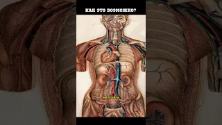 Сердце в правой части груди, как это возможно? #здоровье #медицина