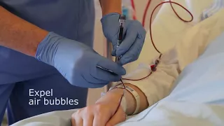 Arterial line sampling to obtain an arterial blood gas