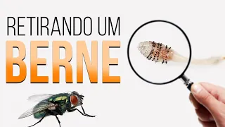 Retirando um BERNE | Professor Guilherme