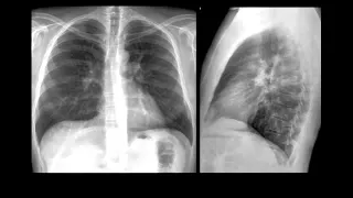 Radiografía de Tórax: Evaluación Básica Inicial