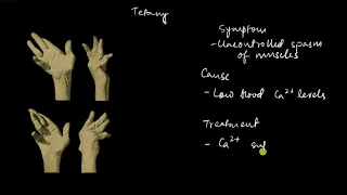 Musculoskeletal system disorders | Locomotion and movement | Biology | Khan Academy