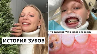 ИСТОРИЯ ЗУБОВ / и это не конец!🦷