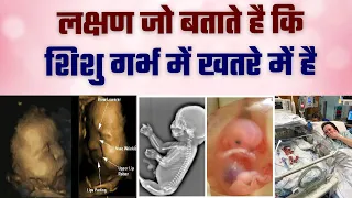 ये लक्षण बताते है की गर्भ में बच्चा खतरे में है | Symptoms of Unhealthy Baby During Pregnancy