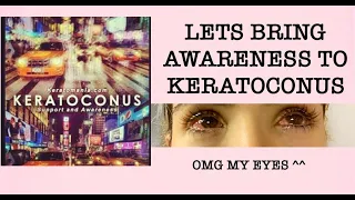 BRINGING AWARENESS TO KERATOCONUS | EYE CONDITION | SCLERAL LENSES | The Chanel Channel