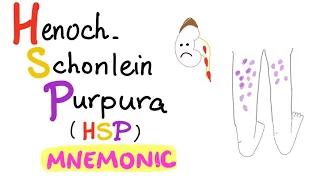 Henoch-Schönlein Purpura (HSP) Mnemonic