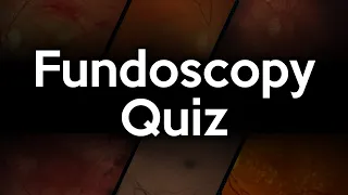 Fundoscopy Quiz