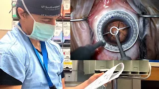 DAY IN THE LIFE: YOUNG EYE SURGEON
