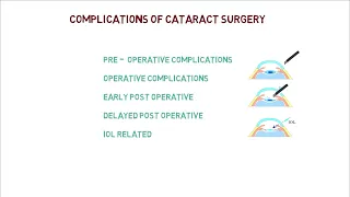 complications of cataract surgery