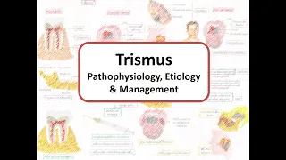 Trismus (or Lockjaw): Pathophysiology, Etiology & Management