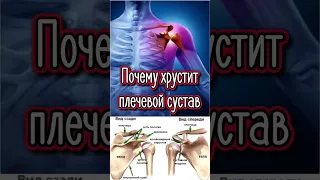 Почему хрустит плечевой сустав