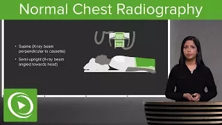 Normal Chest Radiography – Radiology | Lecturio