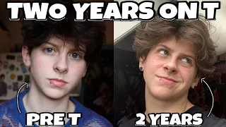 2 YEARS ON TESTOSTERONE (FTM TRANSGENDER) | NOAHFINNCE