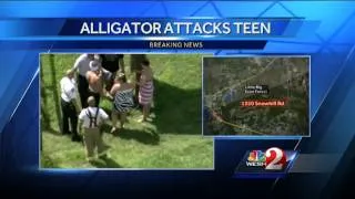 Boy, 17, suffers gator bite to head