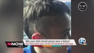 Why your child should always wear a helmet when biking