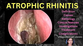 193.Atrophic Rhinitis part 1/2 #anatomylectures #nose #rhinitis #anosmia #smell