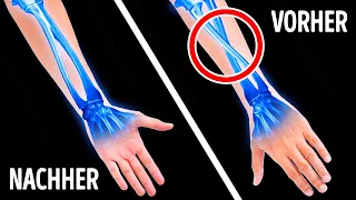 So kreuzen sich die Armknochen, wenn man die Hand nach vorne streckt + andere Körper-Fakten