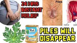 Hemorrhoids|24hr! #Piles_Treatment|How To Use Pawpawleaf To Treat Hemorrhoids|homeremedies for piles