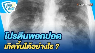 โปรตีนพอกปอด เกิดขึ้นได้อย่างไร ? | รู้ทันกันได้