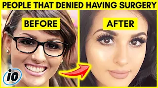 Famous People That Denied Having Cosmetic Surgery | Marathon