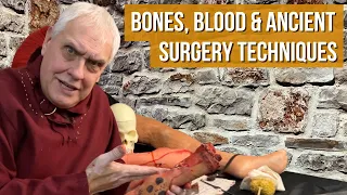 Ancient Surgery Techniques | Repairing Wounds & Surviving Pain