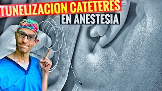 TUNELIZACIÓN DE CATÉTER EN ANESTESIA