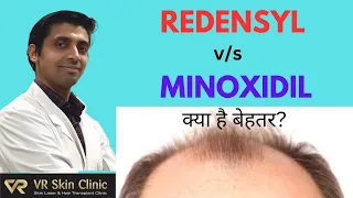 Is REDENSYL Better Than MINOXIDIL For Pattern Hair Loss? (Hindi) | क्या है बेहतर? | VR Skin Clinic