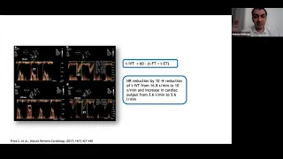 Advanced Echocardiography in shock - Dr. Hatem Soliman