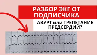 Разбор ЭКГ от подписчика. Предсердная тахикардия. Трепетание предсердий 2:1.