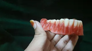 Root Carving | Complete Denture #7 | Prosthodontics