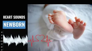 Newborn heart beat sound | How to calculate NB Heart rate | Normal NB Heart sound | Christina NP