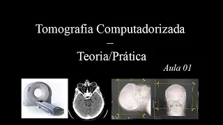 Curso de Tomografia - Aula 1 (Gantry, Scout, FOV, Matriz, Pixel...)