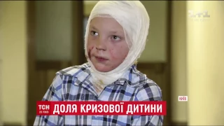 10-річний Сашко одужує після жорстоких знущань вітчима
