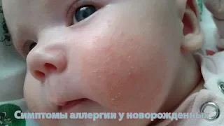 Симптомы аллергии у новорожденных