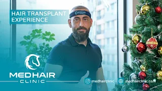 Hair Transplant in One of The 𝐓𝐨𝐩 𝐑𝐚𝐭𝐞𝐝 𝐂𝐥𝐢𝐧𝐢𝐜𝐬 𝐢𝐧 𝐓𝐮𝐫𝐤𝐞𝐲.
