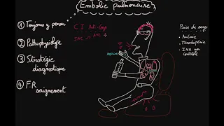 Embolie pulmonaire - Prise en charge - Partie 2 - Docteur Synapse