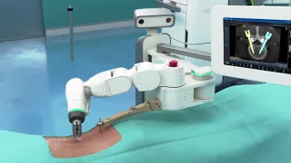 Robotic spine surgery with Mazor X