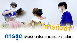 กัวซา ขูดพิษรักษาโรค ด้วยศาสตร์การแพทย์แผนจีน