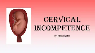 [O&G] Cervical incompetence, cervical cerclage