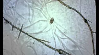 Życie w kropli wody - film spod mikroskopu biologicznego.