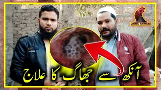 My Chicken Eye Is Swollen | Aseel Murga Ki Ankh Se Jhag