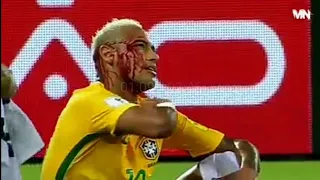 Neymar Jr Injuries that changed his career