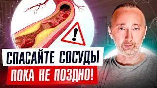 Эти травы и продукты чистят сосуды, снижают плохой холестерин и разжижают кровь! Рецепты и советы.