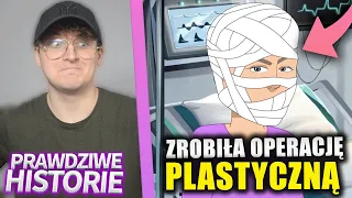 ZROBIŁA OPERACJĘ PLASTYCZNĄ *nie wyszła xD*