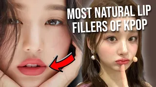Kpop Idols Whose LIP FILLER Does Not Look Botched