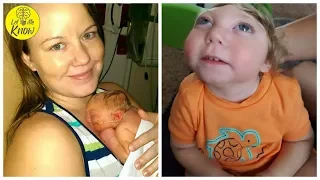 This Two Year Old Boy Was Born With Such An Extreme Defect That His Survival Is A Miracle