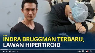 Kabar Terbaru Aktor Indra Bruggman, Lawan Hipertiroid Hingga Berat Badan Susut 10 Kg