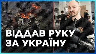 Медичний прорив у протезуванні: Як біонічна рука змінює життя військового