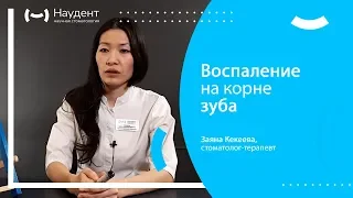 Воспаление на корне зуба