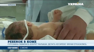 В Черкассах ребёнок впал в кому, сразу после рождения