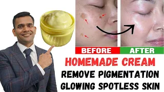 Remove Dark spots, Pigmentation And Get Younger Glowing Spotless Skin - Dr. Vivek Joshi